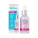 Resurfacing Peel Complexion Serum BBB16404, 30 ml, Bye Bye Blemish