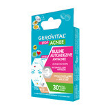 Gerovital Stop Acne auto-adhésif contre l'acné, 30 pièces, Farmec