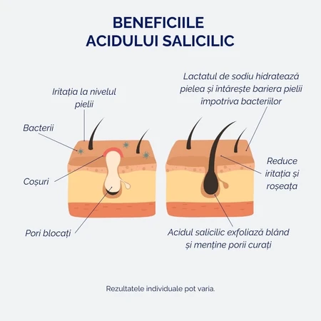 Siero con acido salicilico 2%, per pelli sensibili e a tendenza acneica, 30 ml, Meloni