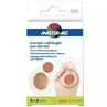 Parches de ácido salicílico para taloneras, 4 + 4 uds, Master Aid