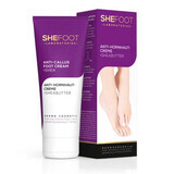 Crema para callos SheFoot, 75 ml, SheCosmetic