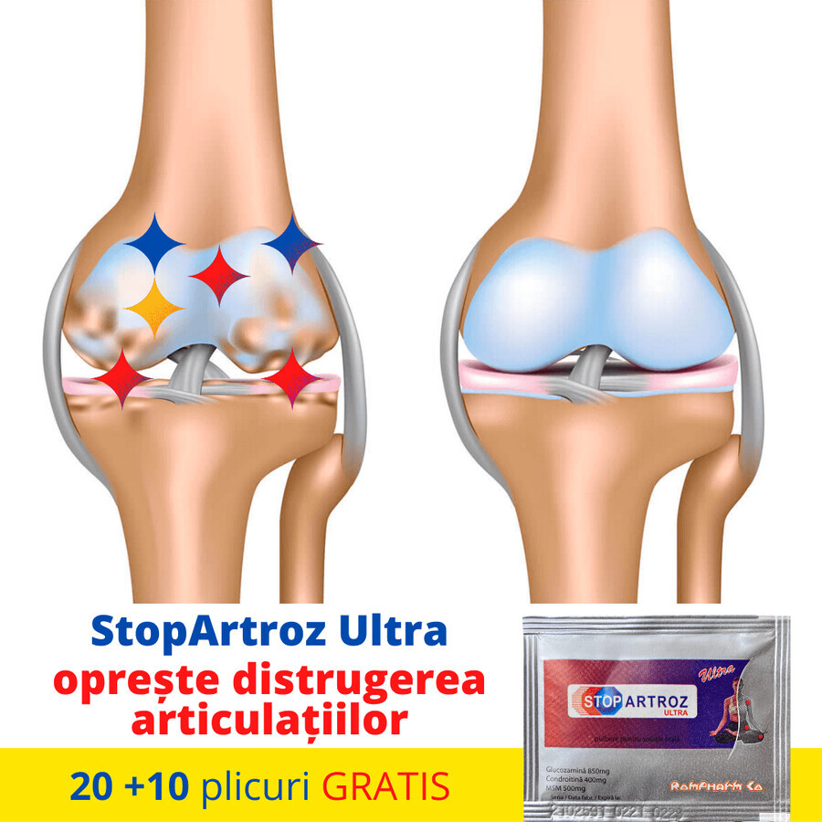 Stopartroz Ultra, 30 sobres, Rompharm