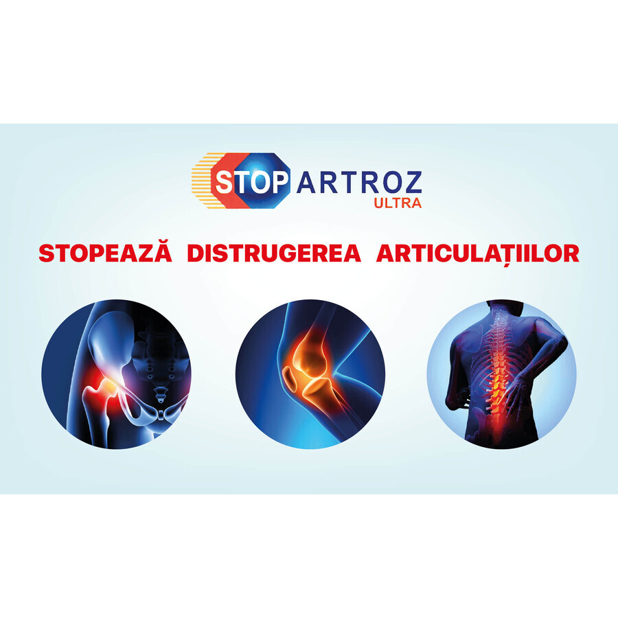 Stopartroz Ultra, 30 sobres, Rompharm