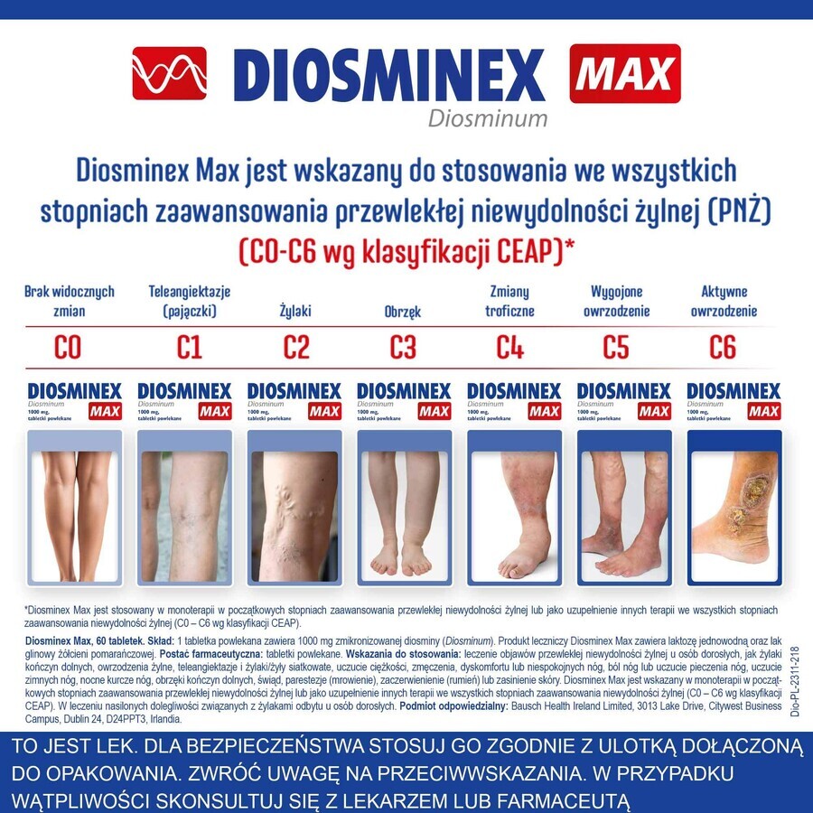 Diosminex Max 1000 mg, 60 tabletten