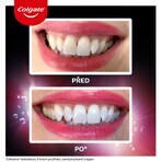 Colgate Max White Ultra Multiprotect Whitening Tandpasta 50 ml