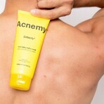 Acnemy Zitbody Gel Limpiador Corporal 200 ml