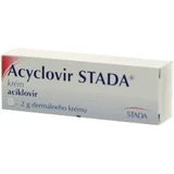 Aciclovir