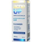 acneUP CLEANSER 1×250 ml, emulsión limpiadora