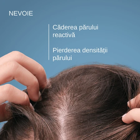 Shampoing Anaphase contre la chute des cheveux, 400 ml, Ducray