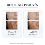 Eucerin Anti-Pigment Siero Duo 30ml