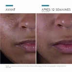 Skinceuticals Silymarin CF Ser antiimperfecțiuni pentru față 30ml