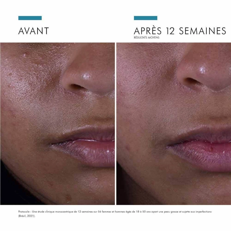 Skinceuticals Silymarin CF Ser antiimperfecțiuni pentru față 30ml