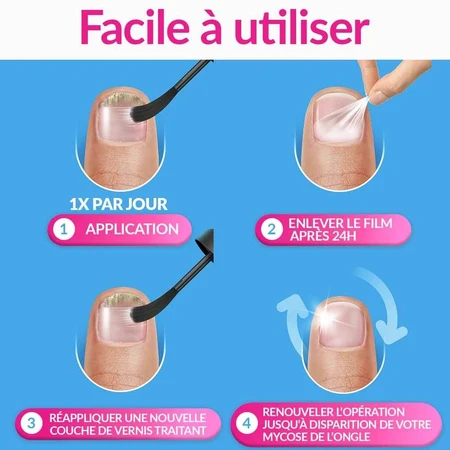 Excilor Tratamiento Hongos Uñas Fuerte 30ml