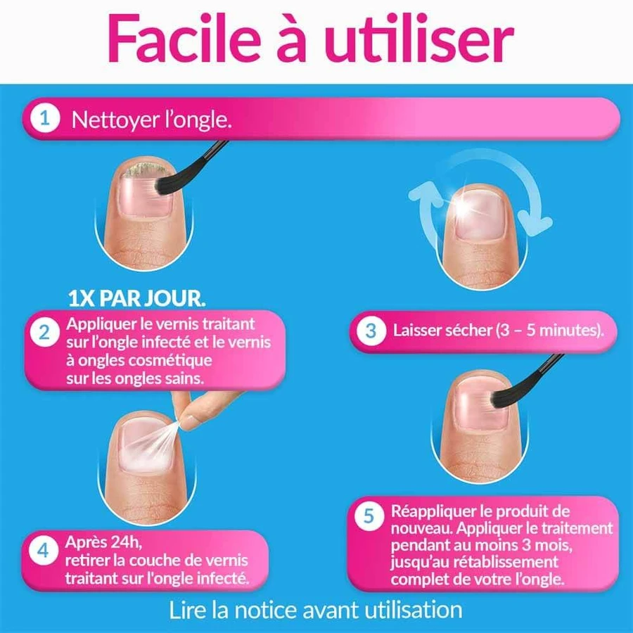 Excilor Tratamiento Hongos Uñas Coloración Fuerte Nude 30ml