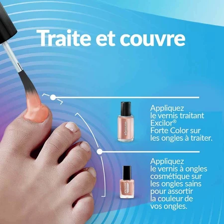 Excilor Tratamiento Hongos Uñas Coloración Fuerte Nude 30ml