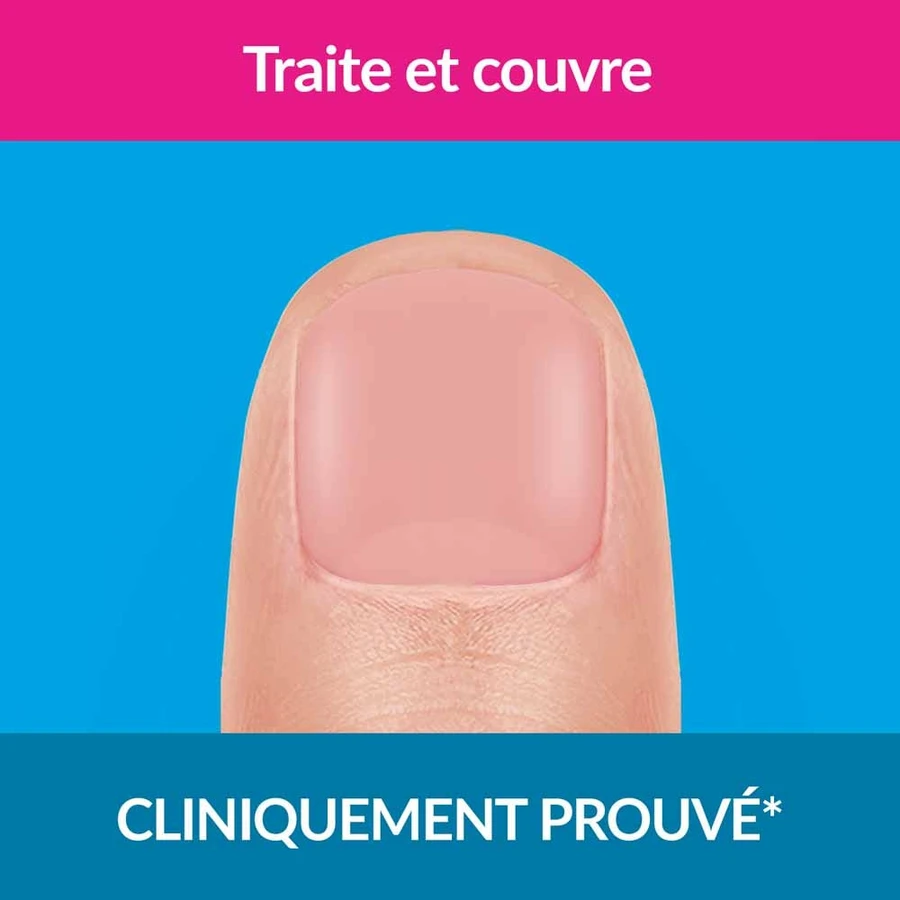 Excilor Tratamiento Hongos Uñas Coloración Fuerte Nude 30ml
