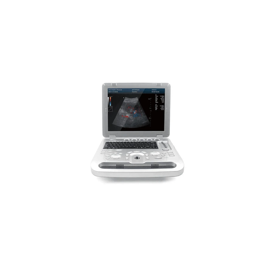 Ecografo Contec CMS1700B