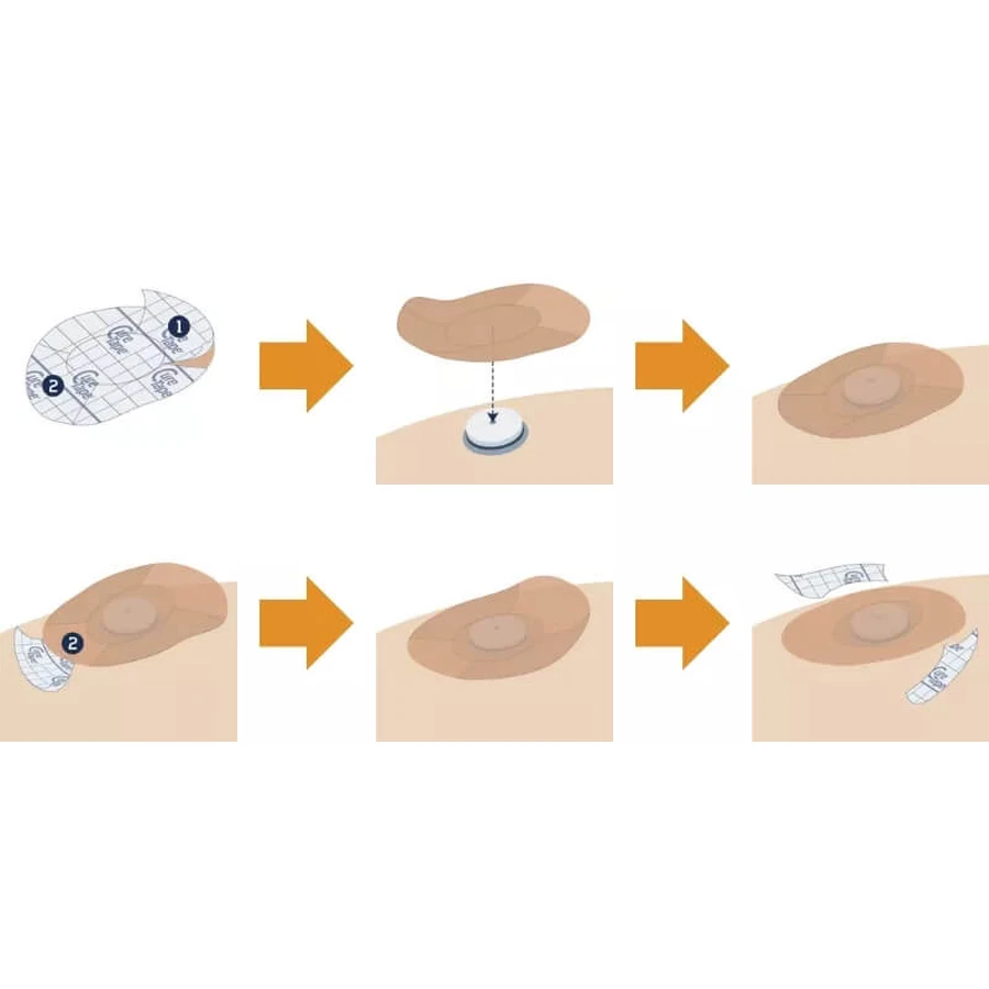 Cerotti per sensori CureTape, cerotti per sensori CGM per il monitoraggio del glucosio, colori misti, 8 pezzi