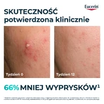 Eucerin DermoPure Clinical Triple Action, serum potrójnym działaniu do skóry tłustej i trądzikowej, 40 ml: ceny i cechy