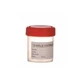 Contenedor Urocultivo, Estéril, 60ml, Minuto
