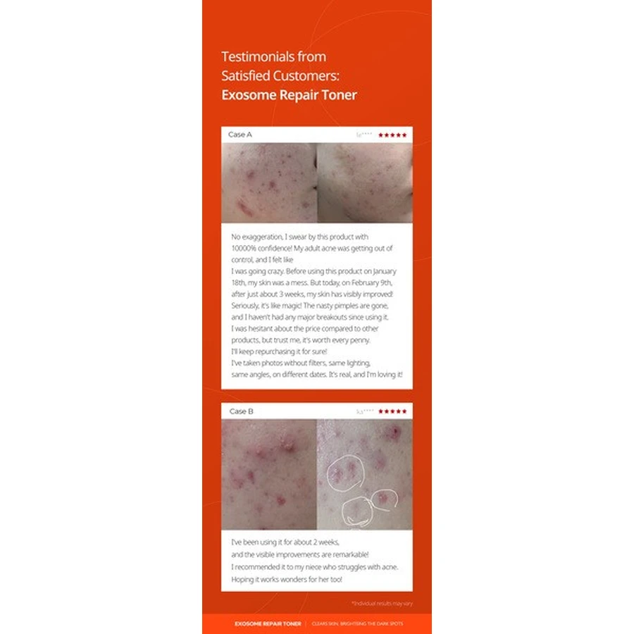 Dr.Melaxin Exosome Repair Toner, toner reparator cu exosomi, 300 ml