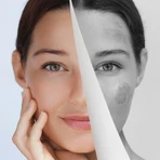 Miraculum Anti-Pigmentatie, handcrème om verkleuringen te corrigeren, 75 ml