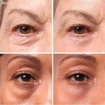 It Cosmetics Bye Bye Under Eye Bag - Oogcrème 15 ml