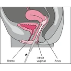 Vagisan Crema hidratante vaginal, 25 g, Dr. Wolff