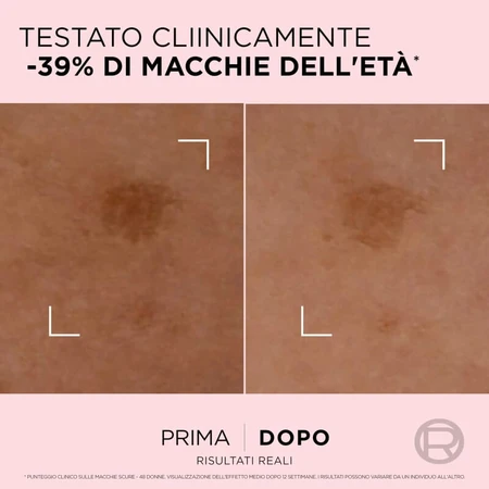 L'Oréal Paris Golden Age - ser corector cu acțiune rapidă împotriva petelor, 30 ml