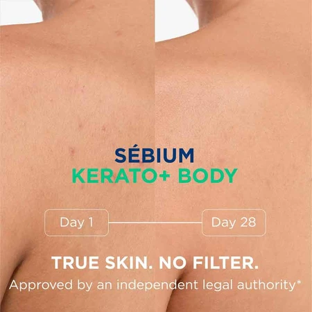 Sebium Kerato+ Body Spray, 2x150 ml, Bioderma